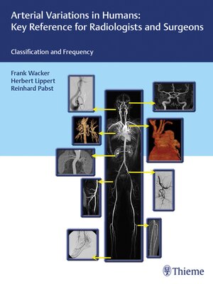 cover image of Arterial Variations in Humans